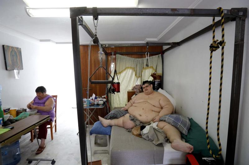 AFP - Muere Juan Pedro Franco, el mexicano conocido por haber sido el hombre más obeso del mundo
