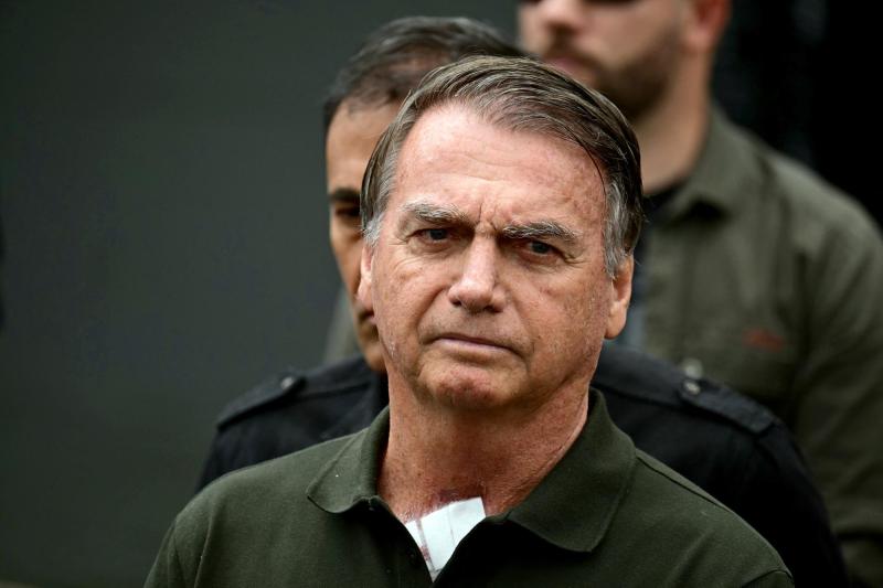 T13 - Jair Bolsonaro será sometido a procedimiento médico por crisis de hipo | AFP