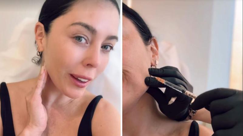 Instagram - Daniela Aránguiz sorprende con su retoque estético