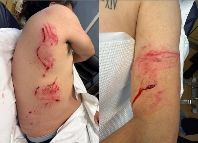 Senadora denuncia que ICE usó engaño y perro de ataque contra migrante en Estados Unidos - X Senator Patty Murray