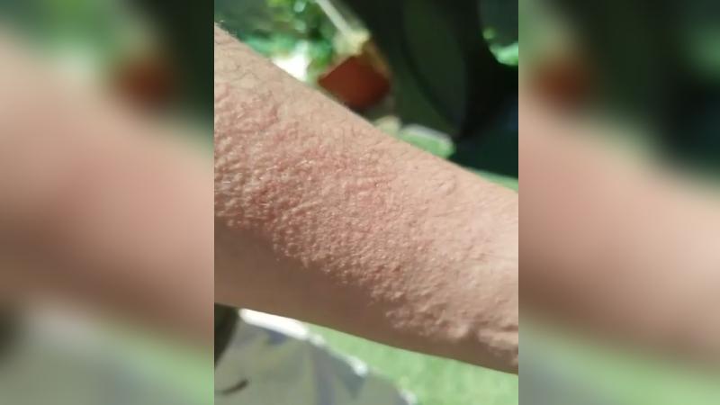 La Tarde es Nuestra - Reabre crematorio que estaría enfermando a vecinos en Talca