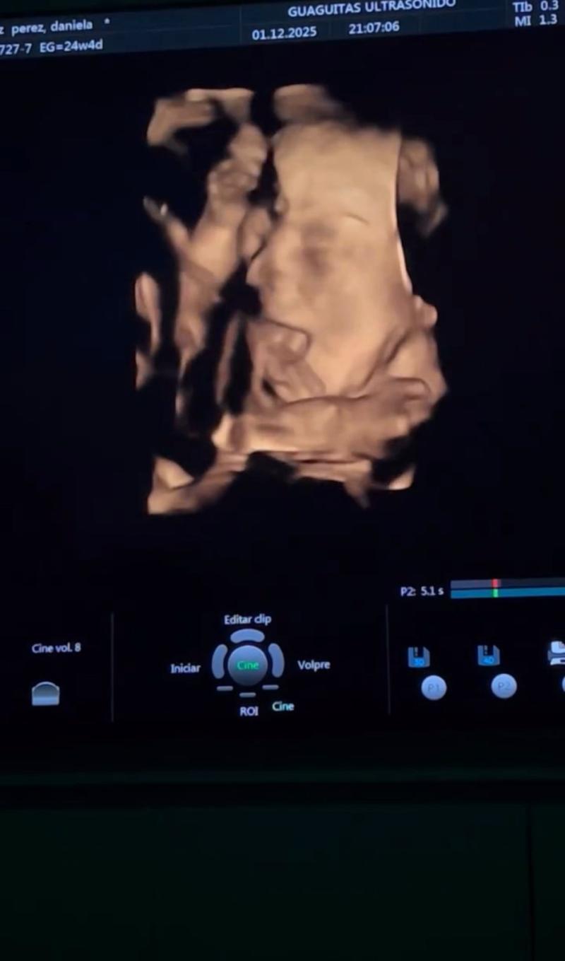 Instagram - Bebé de Camilo Zicavo y Daniela Pérez