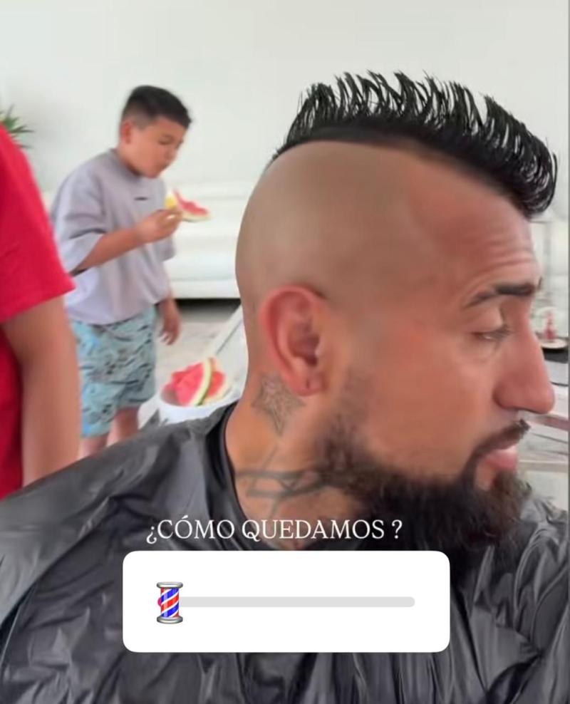 Arturo Vidal y el retoque en su look | Instagram