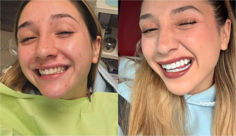 Instagram - Carlita Inostroza