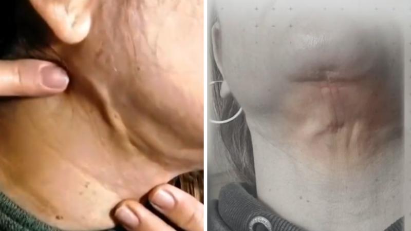 La insólita respuesta de médico de clínica estética denunciada - T13