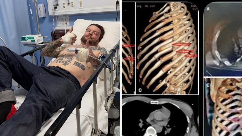 Instagram - El grave accidente de Corey Harrison de 'El precio de la historia'