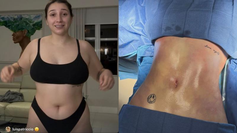 @c4rliita - Carlita impacta con su cambio físico tras operación estética