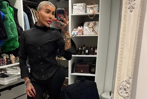 Instagram - Muere hombre conocido como el "rey de los labios": investigan presunta negligencia médica