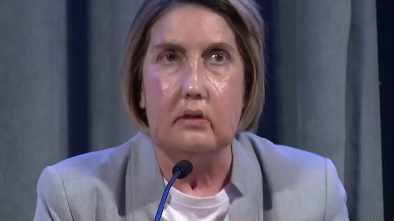 T13 Tarde - Primer trasplante de cara en el mundo