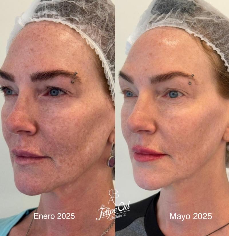 Instagram - Catalina Pulido