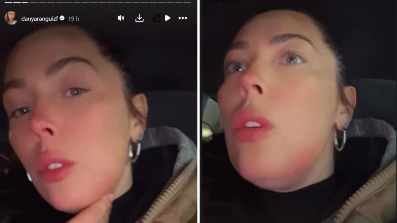 Captura de Instagram - Así quedó el rostro de Daniela Aránguiz