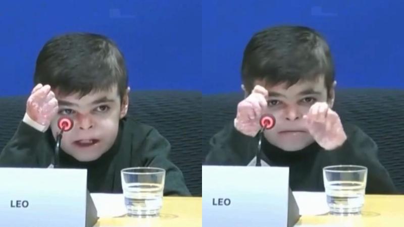 Instagram (ABC_DIARIO) - Niño de 12 años con piel de mariposa hace desgarradora súplica ante el parlamento europeo