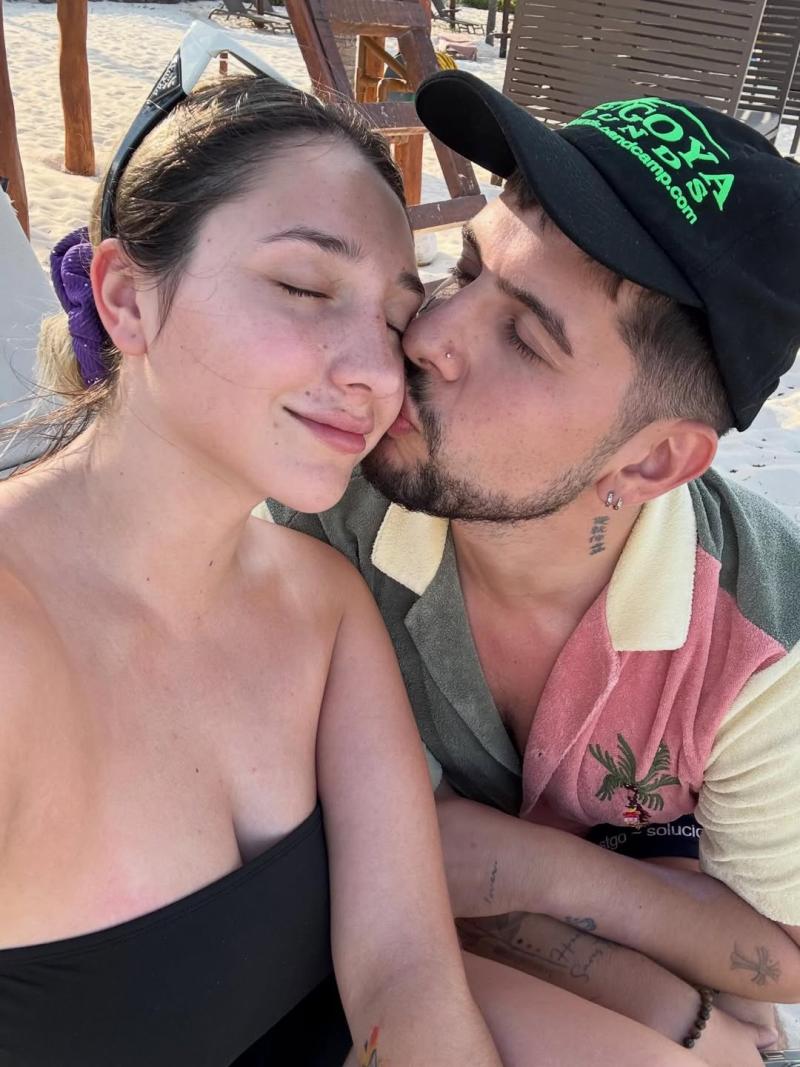 Carlita Inostroza se refirió a las secuelas psicológicas de su cirugía estética: "Esos complejos jamás salen de la mente" - Instagram Carla Inostroza