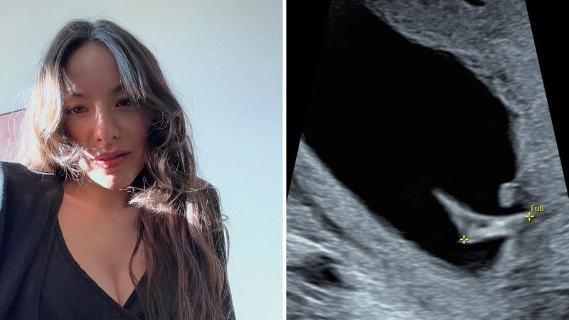 Instagram - Antonia Giesen enterneció las redes sociales