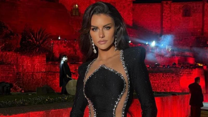 Redes sociales - Emilia Dides impacta al confesar arrepentimiento por procedimiento estético en su rostro