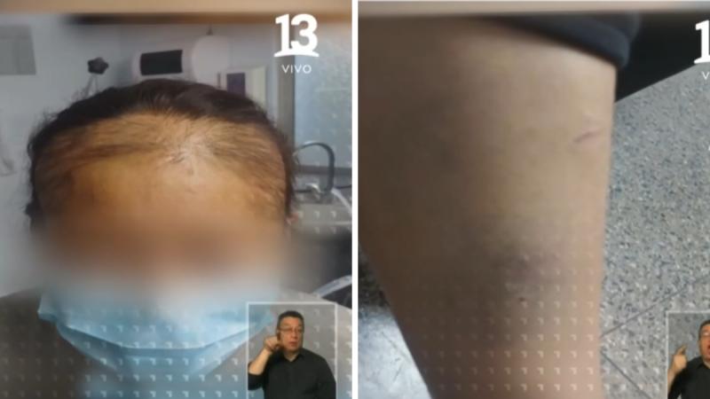 Femicidio frustrado en Rengo: hombre torturó a su pareja - T13