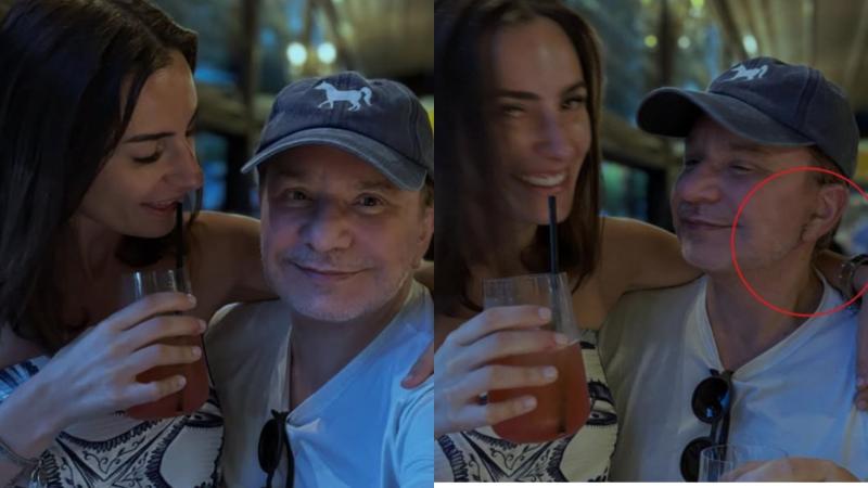 Instagram - La reflexión del hijo de 6 años del esposo de Rosario Bravo que lo llevó a operarse el rostro