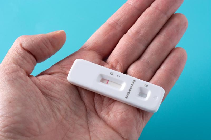 Magnific (referencial) - ISP emite alerta por test rápido de VIH