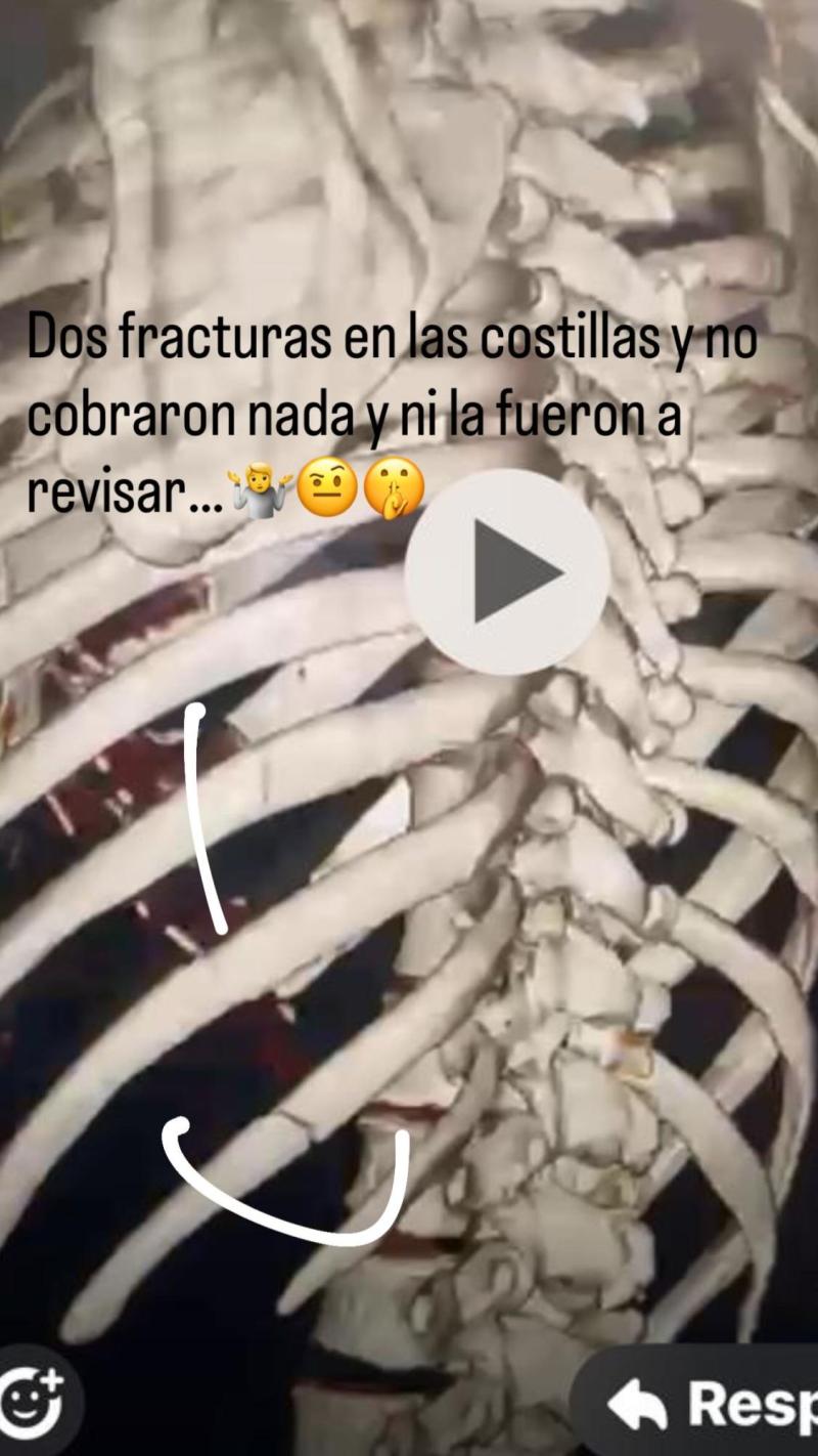 “No cobraron nada”: el duro reclamo de Eduardo Vargas tras sufrir dos fracturas previo a debut de la U en Copa Chile - RRSS Eduardo Vargas