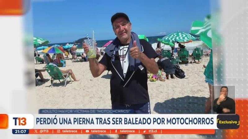Retiró $1,3 millones del banco, lo balearon y terminó con una pierna amputada: investigan a banda de "motochorros"