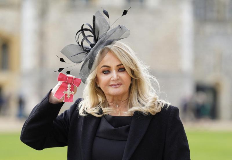 AFP - La cantante Bonnie Tyler salió del coma inducido