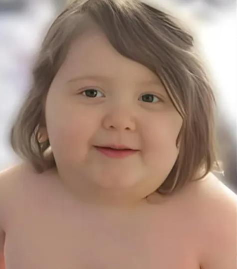 Casper murió por complicaciones asociadas a su obesidad extrema - Sharp Funeral Homes
