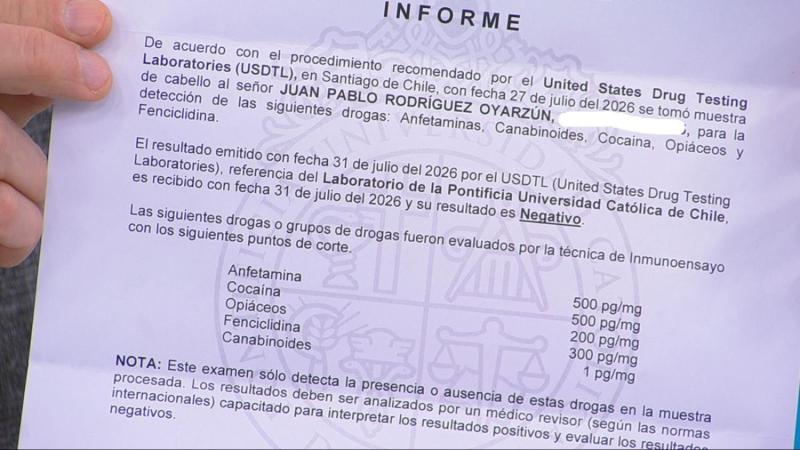 Resultados test de pelo del exsubsecretario Rodríguez - Mesa Central
