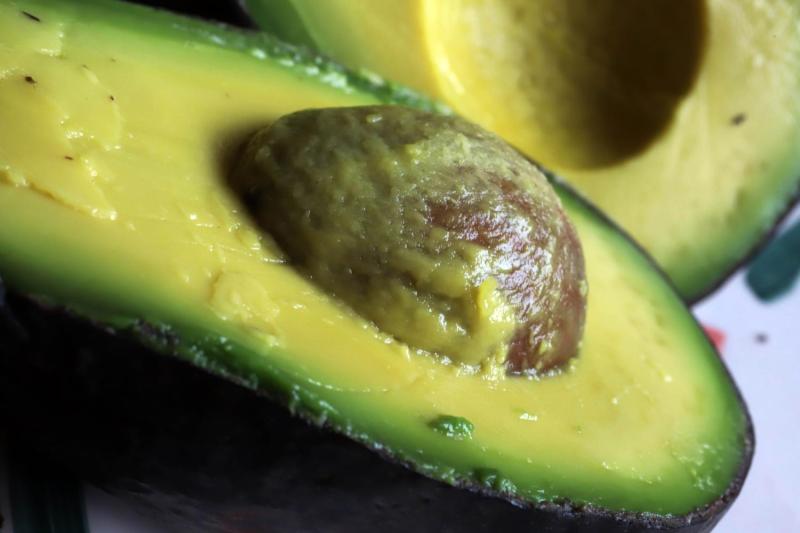 Aumentan las atenciones de urgencia por la “mano de palta” en Alemania: ¿qué es y por qué preocupa? - Agencia Uno