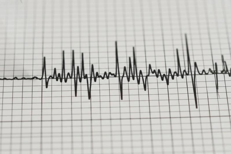Referencial Temblor | Agencia UNO