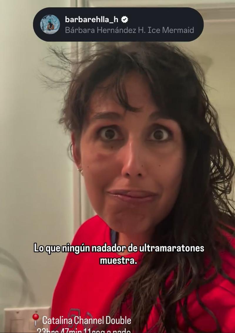 Captura - Bárbara Hernández mostró los efectos en su cuerpo