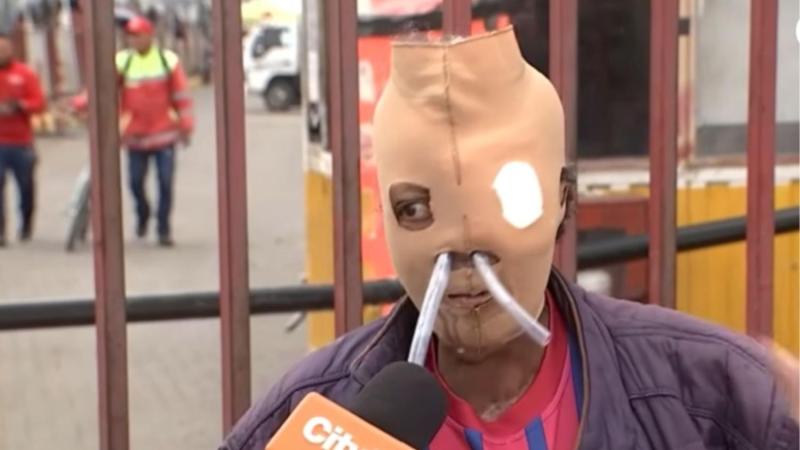 Youtube - La historia de María Consuelo Córdoba, la mujer que fue atacada con ácido por su esposo y que ahora pide la eutanasia