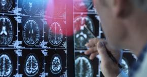Chile podría ser el primer país en proteger por ley los neuroderechos Chile podría ser el primer país en proteger por ley los neuroderechos