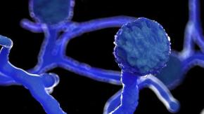 Mucormicosis, el raro y peligroso "hongo negro" que afecta a pacientes de COVID-19 en India Mucormicosis, el raro y peligroso "hongo negro" que afecta a pacientes de COVID-19 en India