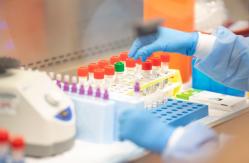 Estudio plantea que variante Epsilon del coronavirus es resistente a vacunas Pfizer y Moderna Estudio plantea que variante Epsilon del coronavirus es resistente a vacunas Pfizer y Moderna
