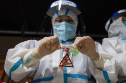China denuncia la "arrogancia" de la OMS por querer investigar el origen del covid China denuncia la "arrogancia" de la OMS por querer investigar el origen del covid