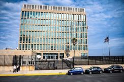 Qué es el misterioso "síndrome de La Habana" que amenazaría a diplomáticos de EEUU Qué es el misterioso "síndrome de La Habana" que amenazaría a diplomáticos de EEUU
