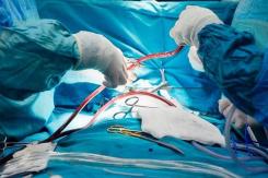 Ecuador: Mujer termina con pinza dentro de su vientre tras dar a luz Ecuador: Mujer termina con pinza dentro de su vientre tras dar a luz