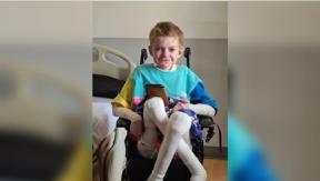 Niño con "piel de cristal" y que podría morir con un corte de papel supera expectativas: Cumplirá 16 Niño con "piel de cristal" y que podría morir con un corte de papel supera expectativas: Cumplirá 16