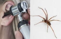 Mujer acude al médico por dolor de oído: Médico encontró una araña en su interior Mujer acude al médico por dolor de oído: Médico encontró una araña en su interior