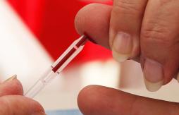 Tras años de investigaciones, sigue sin aparecer la vacuna contra el sida Tras años de investigaciones, sigue sin aparecer la vacuna contra el sida