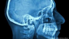 Científicos acaban de identificar una nueva parte del cuerpo humano Científicos acaban de identificar una nueva parte del cuerpo humano