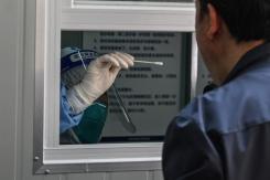 "Deltacron": Los síntomas de la nueva variante del coronavirus confirmada por la OMS "Deltacron": Los síntomas de la nueva variante del coronavirus confirmada por la OMS