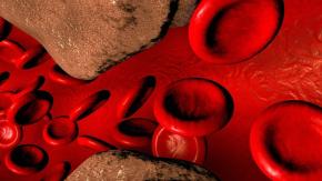 Colesterol: la biomolécula que nadie quiere en su cuerpo y sin la cual estaríamos muertos Colesterol: la biomolécula que nadie quiere en su cuerpo y sin la cual estaríamos muertos