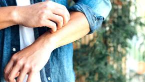 Viruela del mono: cómo saber si tienes esta u otra enfermedad que provoca síntomas similares Viruela del mono: cómo saber si tienes esta u otra enfermedad que provoca síntomas similares