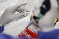 La OMS anunciará el sábado si activa nivel de alerta máxima por viruela del mono La OMS anunciará el sábado si activa nivel de alerta máxima por viruela del mono