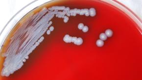 La peligrosa bacteria encontrada en EE.UU. que preocupa a las autoridades de salud del país La peligrosa bacteria encontrada en EE.UU. que preocupa a las autoridades de salud del país
