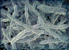 Identifican a bacteria Legionella como causa de brote de neumonía con 4 muertos en Argentina Identifican a bacteria Legionella como causa de brote de neumonía con 4 muertos en Argentina