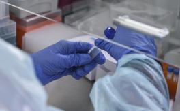Minsal informa 3.766 casos de COVID-19: activos se mantienen en 14 mil por cuarto día consecutivo Minsal informa 3.766 casos de COVID-19: activos se mantienen en 14 mil por cuarto día consecutivo