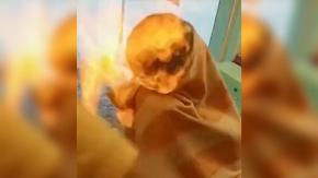 Peluquero realizó corte de pelo con fuego que vio en redes: joven resultó con graves quemaduras Peluquero realizó corte de pelo con fuego que vio en redes: joven resultó con graves quemaduras