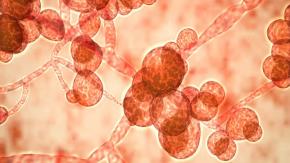 Qué es la Candida auris, el peligroso "superhongo" que fue detectado en Argentina Qué es la Candida auris, el peligroso "superhongo" que fue detectado en Argentina